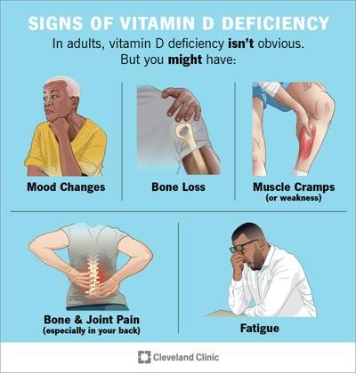 Vitamin D Deficiency Signs